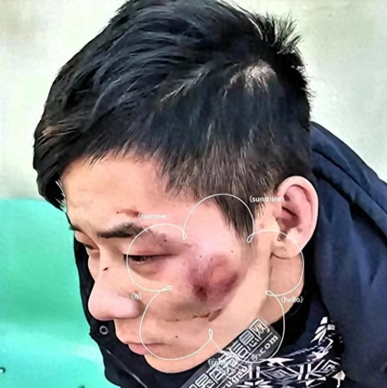 博鱼体育官网-太猖狂！四川凌晨追打事件后续：6人一锅端，被查女子蛮横袭警